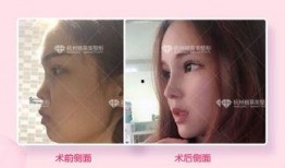 杭州整容爆料案件最新情况,真相逐步浮出水面