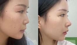 杭州整容爆料案件最新情况,真相逐步浮出水面