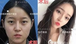 杭州整容爆料案件最新情况,真相逐步浮出水面